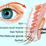 Blepharitis Causes Per Type