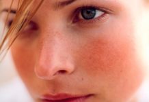 Rosacea: Treatment, types, causes, and symptoms rosacea-cure