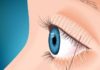 MGD-Meibomian Gland Dysfunction: Symptoms, Treatments and More mgd-meibomian-gland-dysfunction